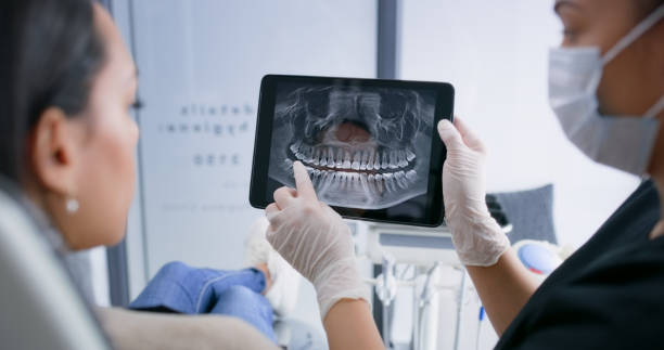 Licensed Tooth Extraction service in Farmington, MI - Smile Center Dentistry